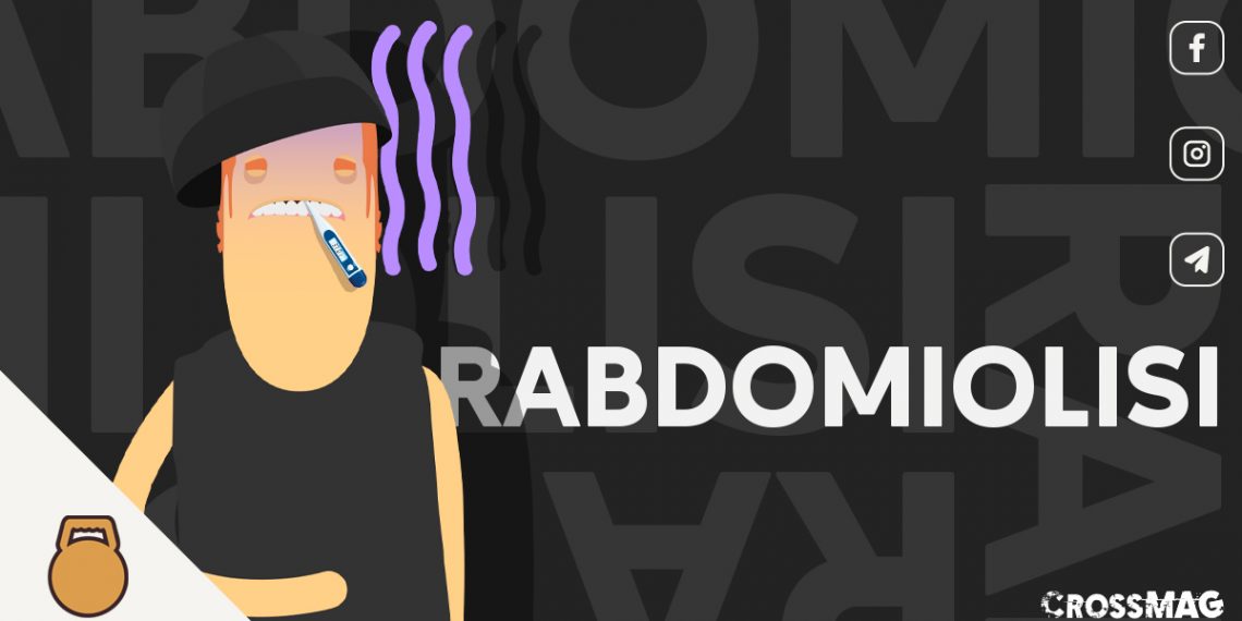 Rabdomiolisi