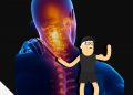 Come risolvere o alleviare le cervicali infiammate con l'esercizio fisico